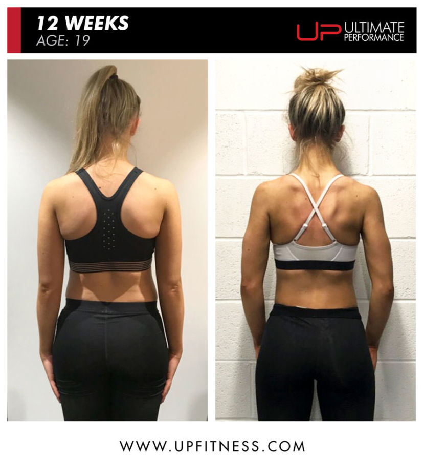 Sofia | Ultimate Performance's before and after back results with Ultimate Performance